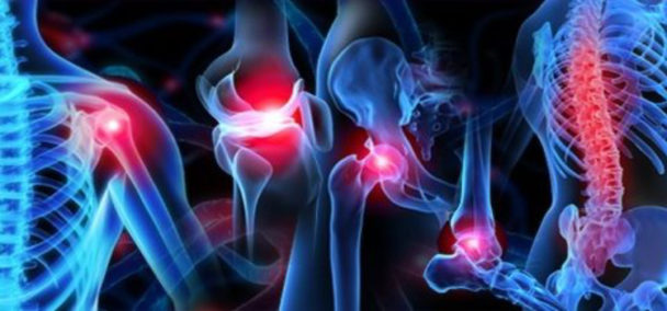 Orthopedics & Joint Replacement