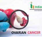 Ovarian Cancer